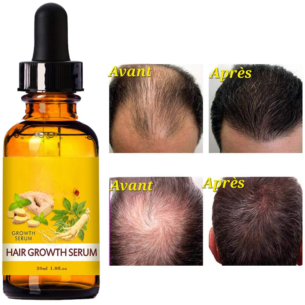 Sérum de croissance rapide des cheveux